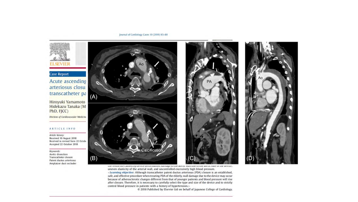 2025 Pediatric Heart Forum Presentation 45페이지