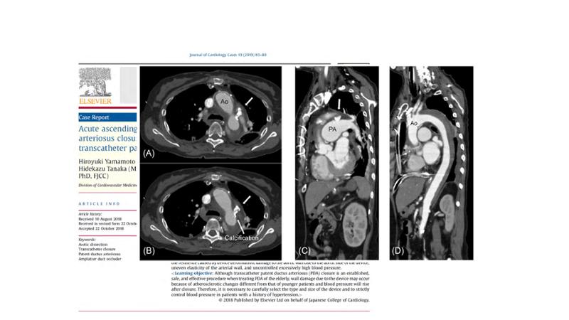 2025 Pediatric Heart Forum Presentation 45페이지
