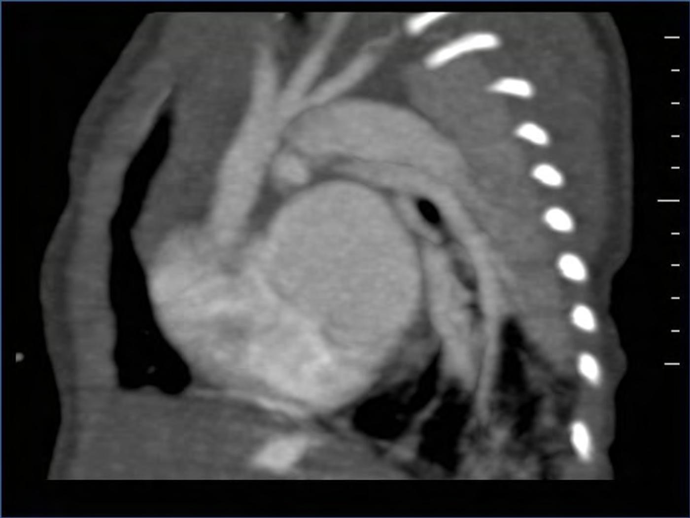 2025 Pediatric Heart Forum Presentation 323페이지