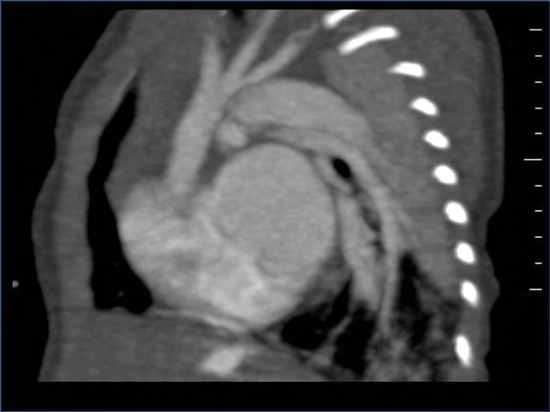 2025 Pediatric Heart Forum Presentation 323페이지