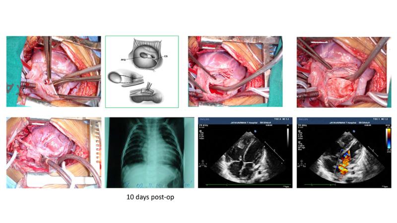 2025 Pediatric Heart Forum Presentation 373페이지