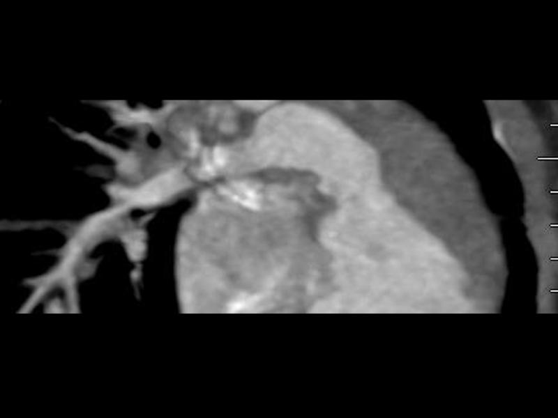 2025 Pediatric Heart Forum Presentation 342페이지