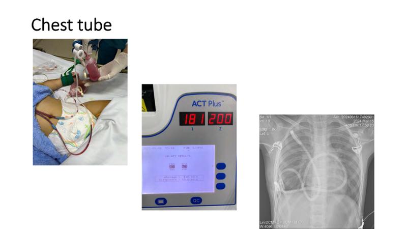 2025 Pediatric Heart Forum Presentation 162페이지