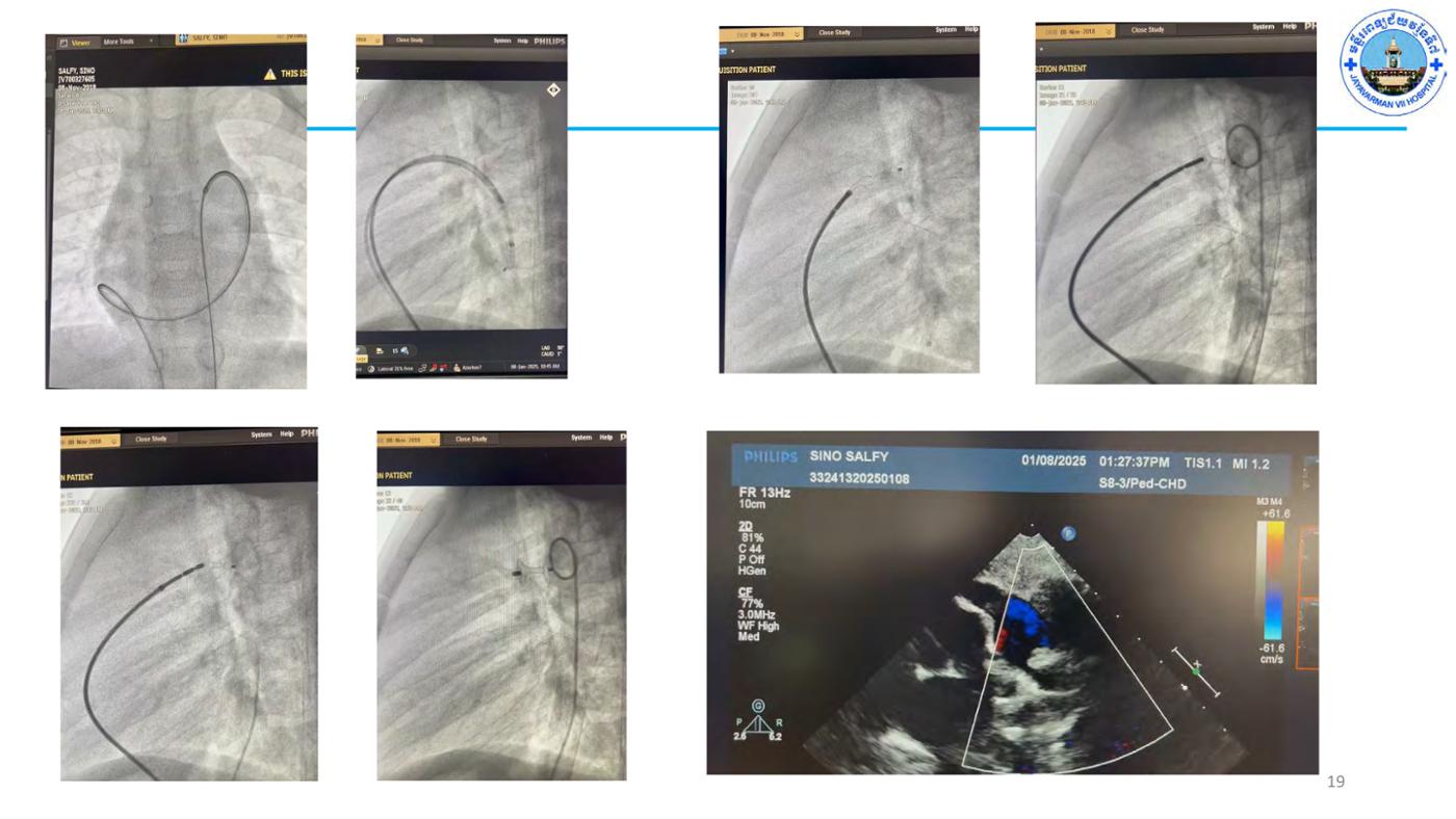 2025 Pediatric Heart Forum Presentation 65페이지