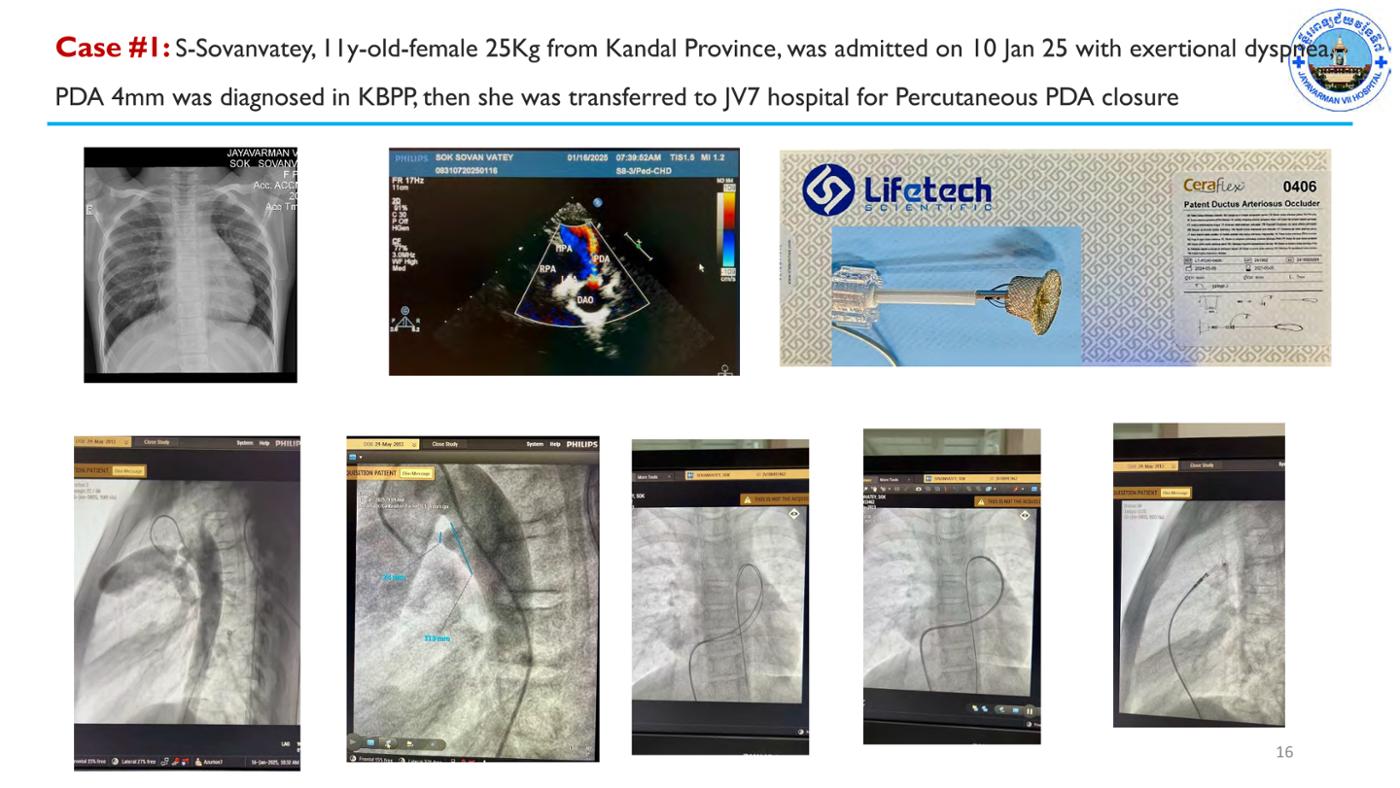 2025 Pediatric Heart Forum Presentation 62페이지