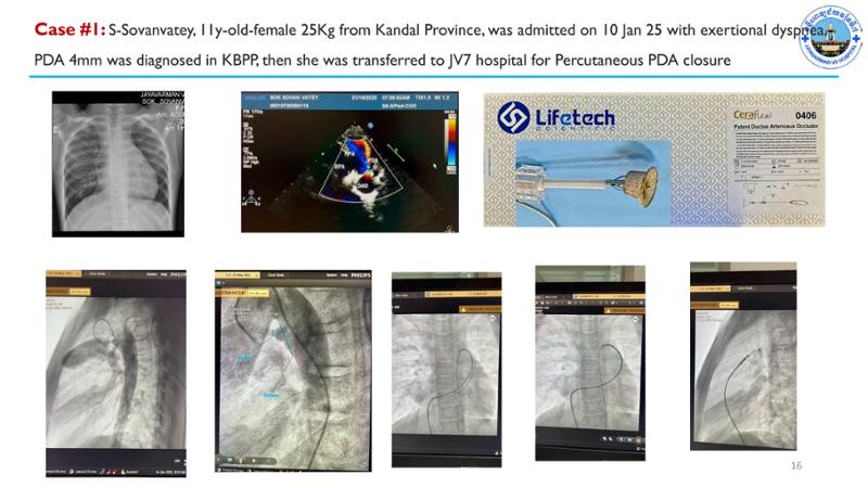 2025 Pediatric Heart Forum Presentation 62페이지