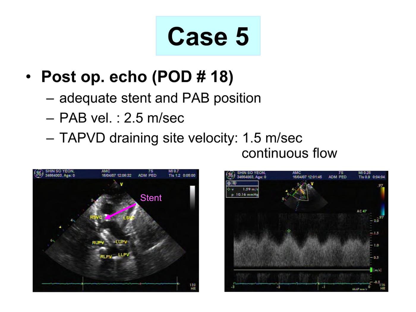 2025 Pediatric Heart Forum Presentation 356페이지