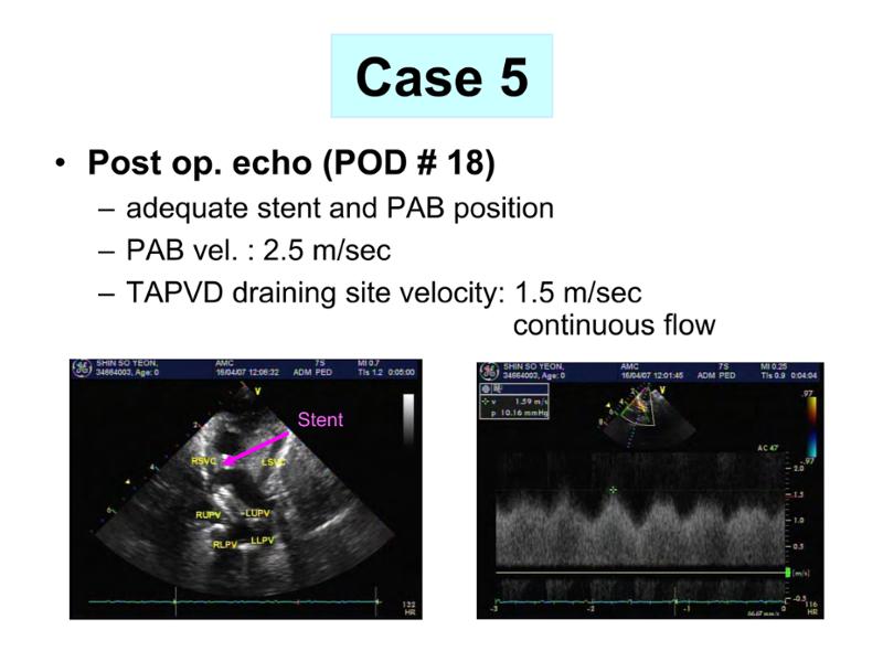 2025 Pediatric Heart Forum Presentation 356페이지