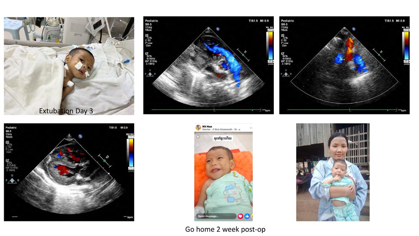 2025 Pediatric Heart Forum Presentation 395페이지