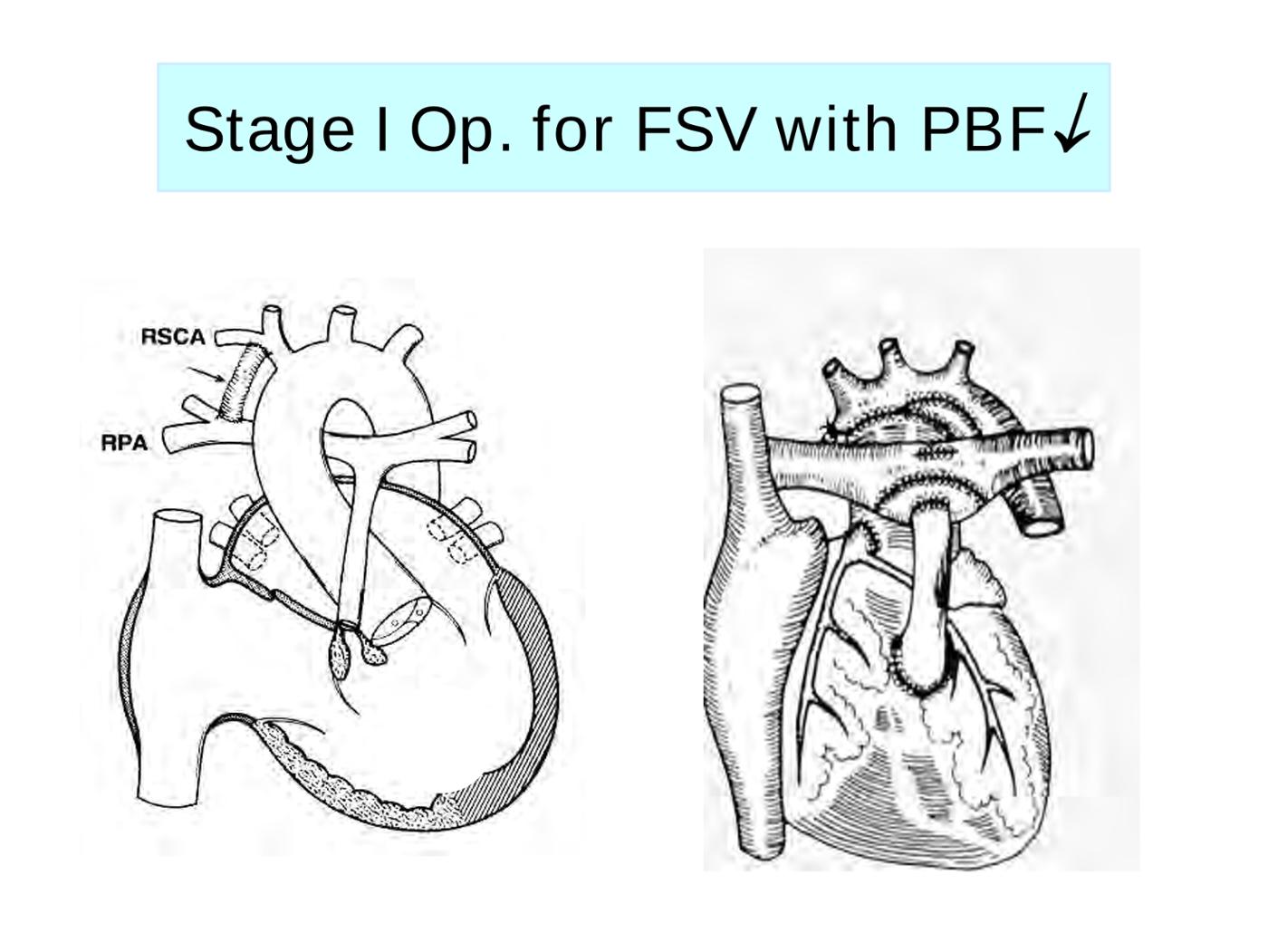 2025 Pediatric Heart Forum Presentation 307페이지