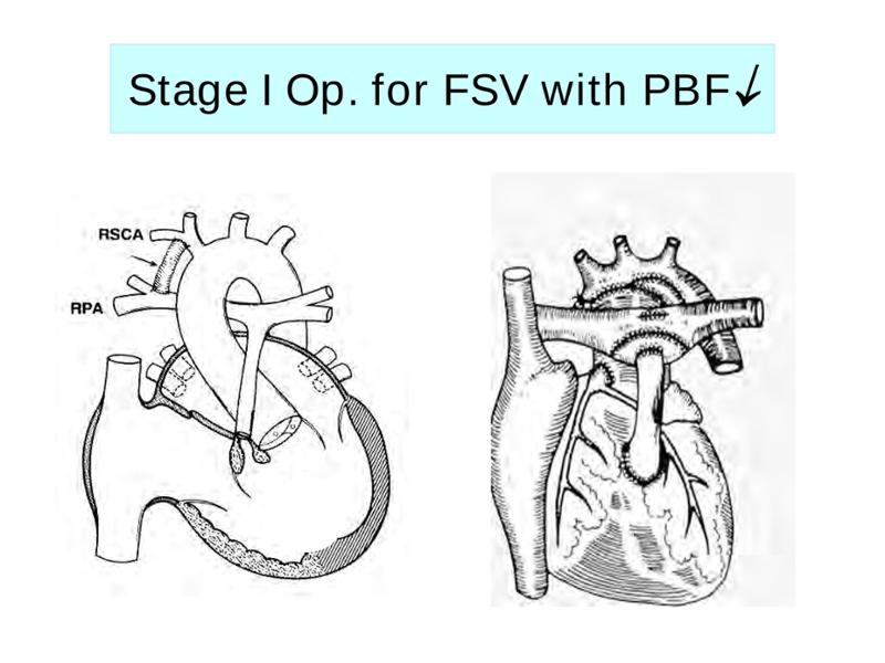 2025 Pediatric Heart Forum Presentation 307페이지