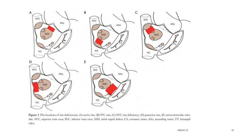 2025 Pediatric Heart Forum Presentation 99페이지