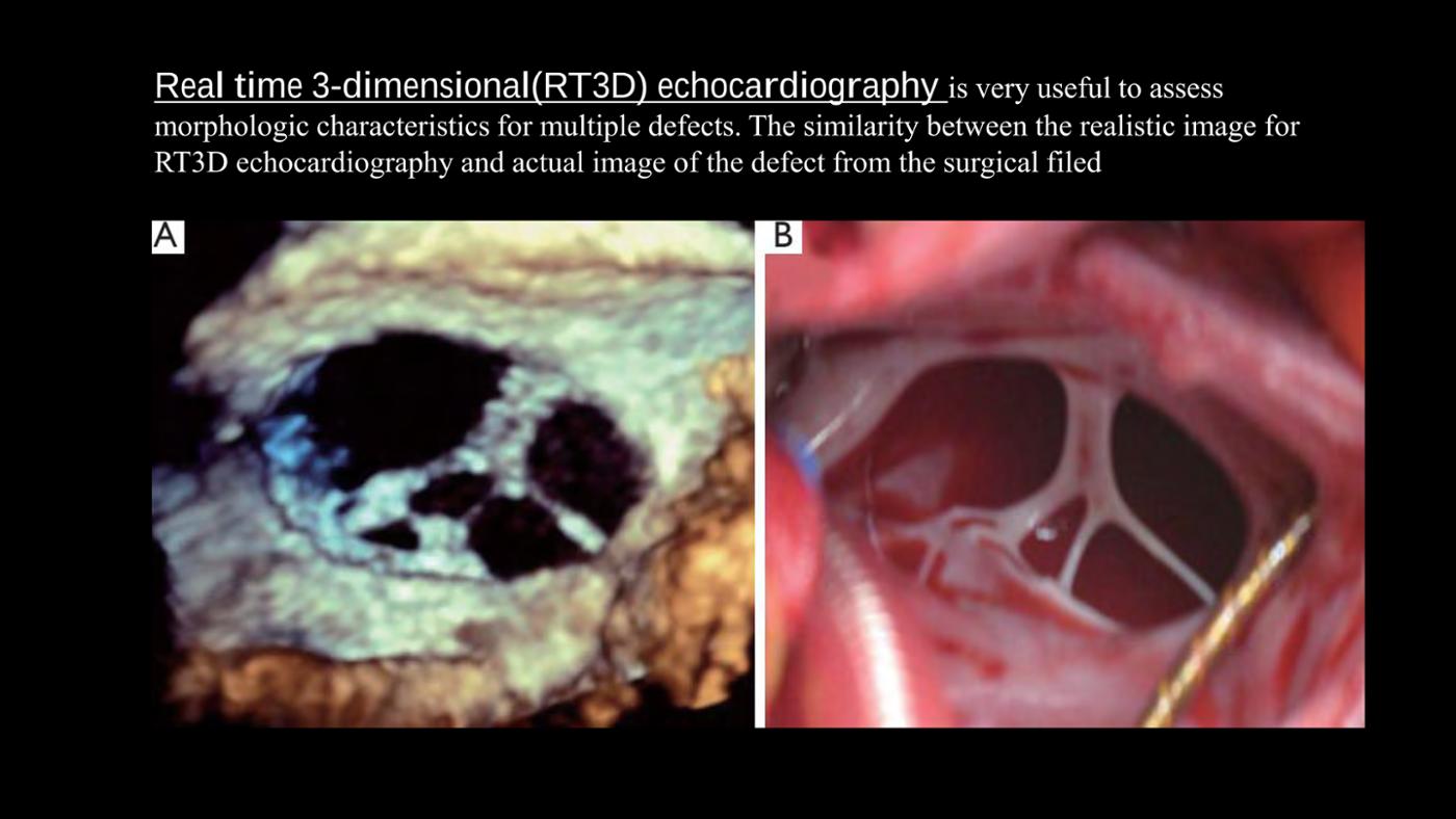 2025 Pediatric Heart Forum Presentation 107페이지