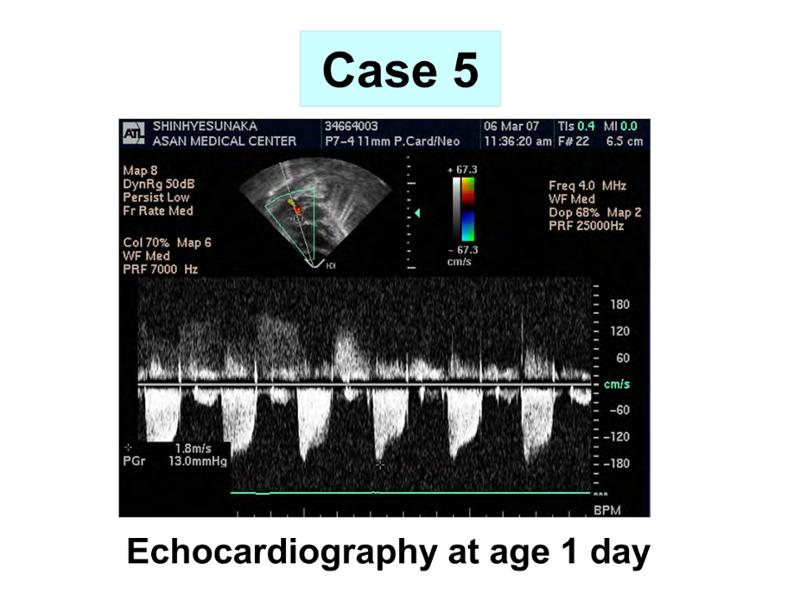 2025 Pediatric Heart Forum Presentation 348페이지