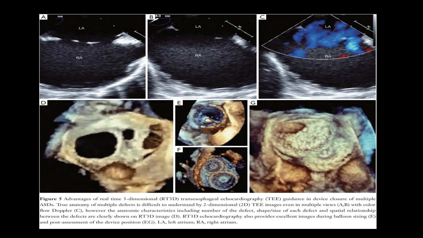 2025 Pediatric Heart Forum Presentation 109페이지
