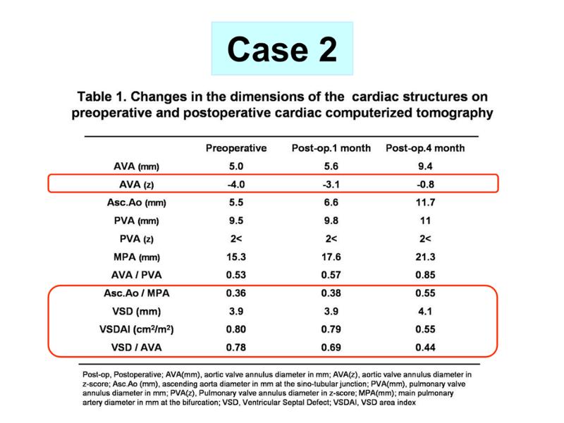 2025 Pediatric Heart Forum Presentation 332페이지