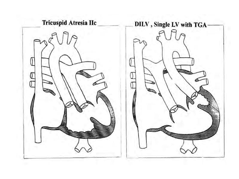 2025 Pediatric Heart Forum Presentation 310페이지