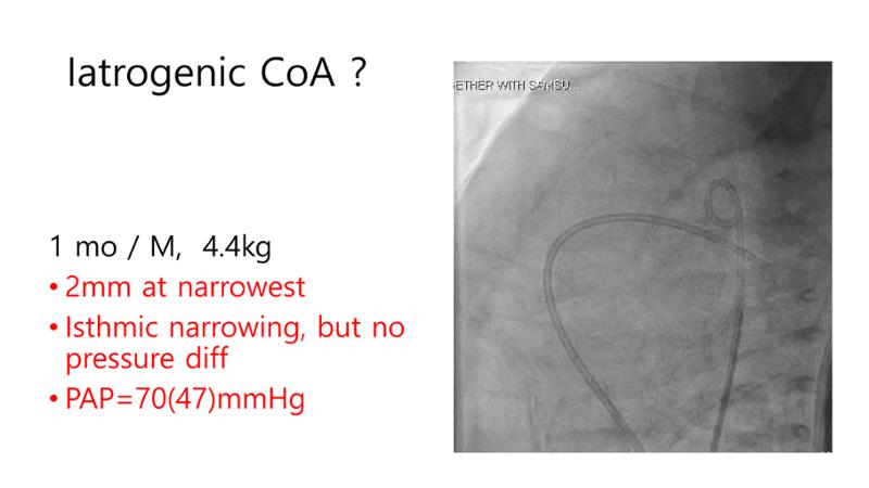 2025 Pediatric Heart Forum Presentation 38페이지