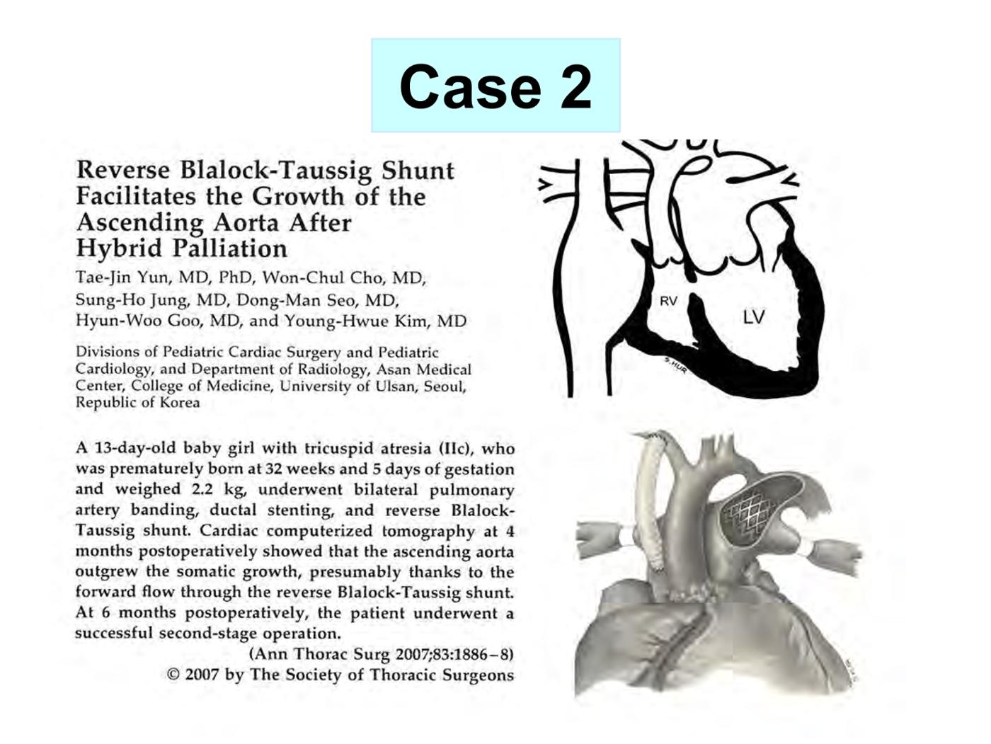 2025 Pediatric Heart Forum Presentation 331페이지