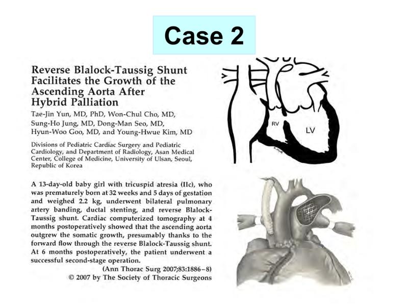 2025 Pediatric Heart Forum Presentation 331페이지