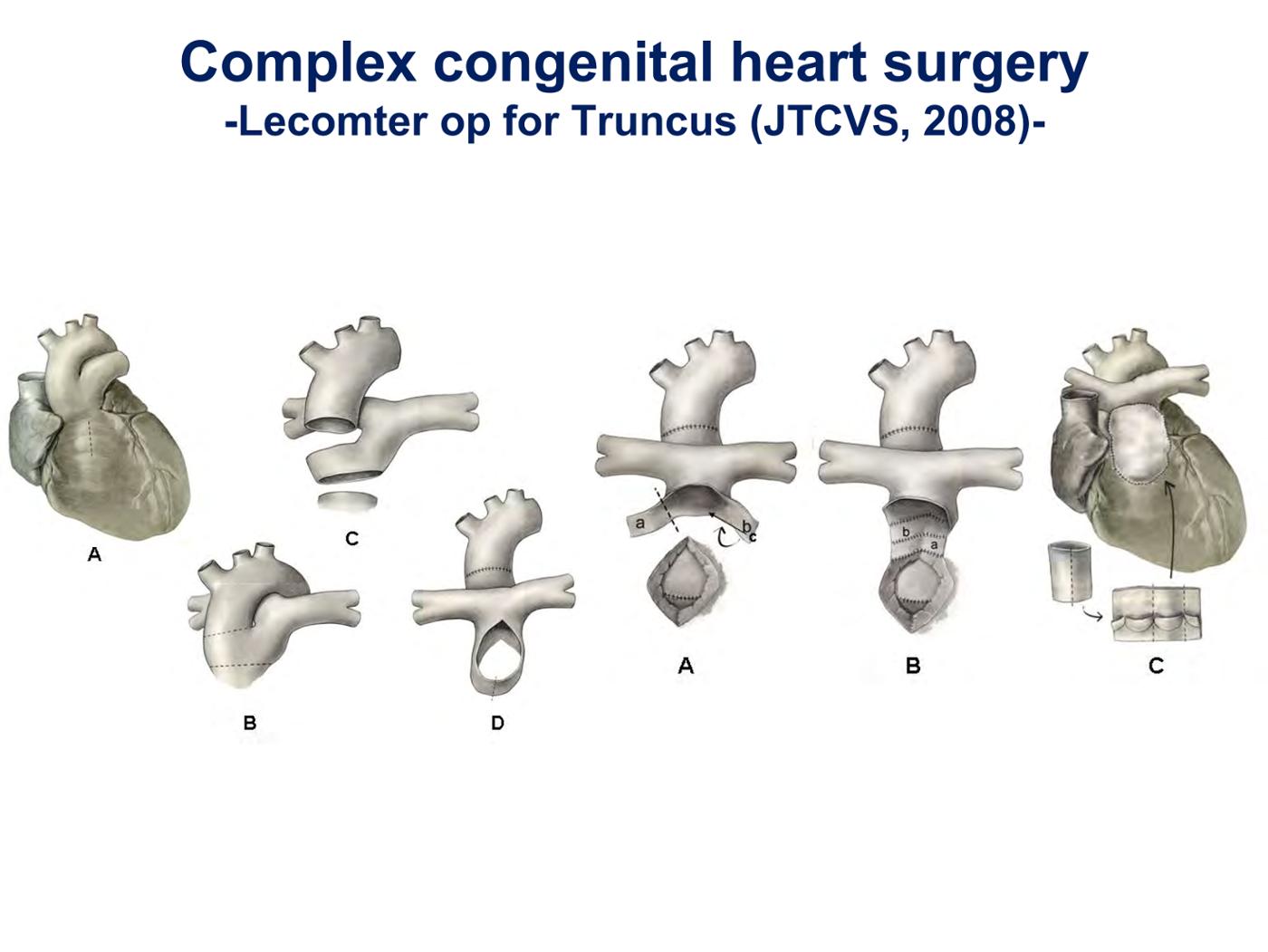 2025 Pediatric Heart Forum Presentation 260페이지