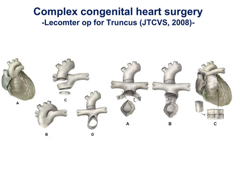 2025 Pediatric Heart Forum Presentation 260페이지