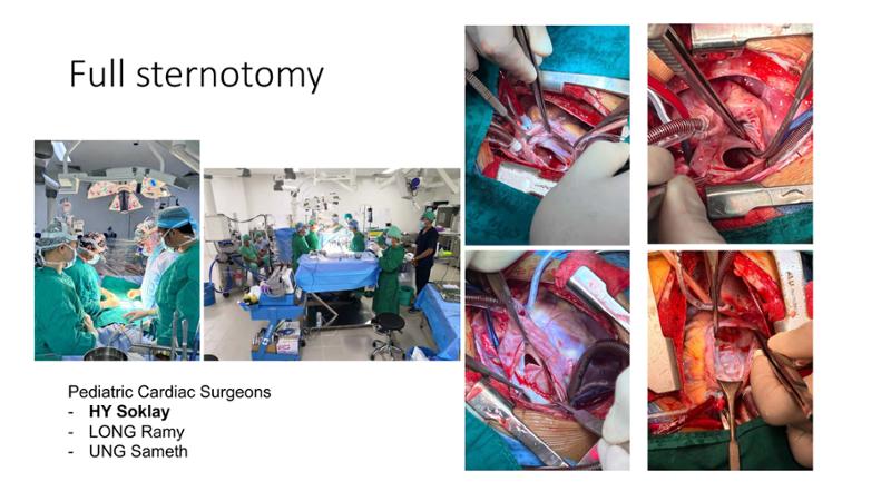 2025 Pediatric Heart Forum Presentation 160페이지
