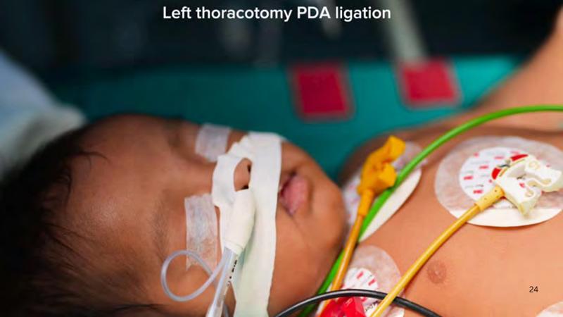 2025 Pediatric Heart Forum Presentation 222페이지