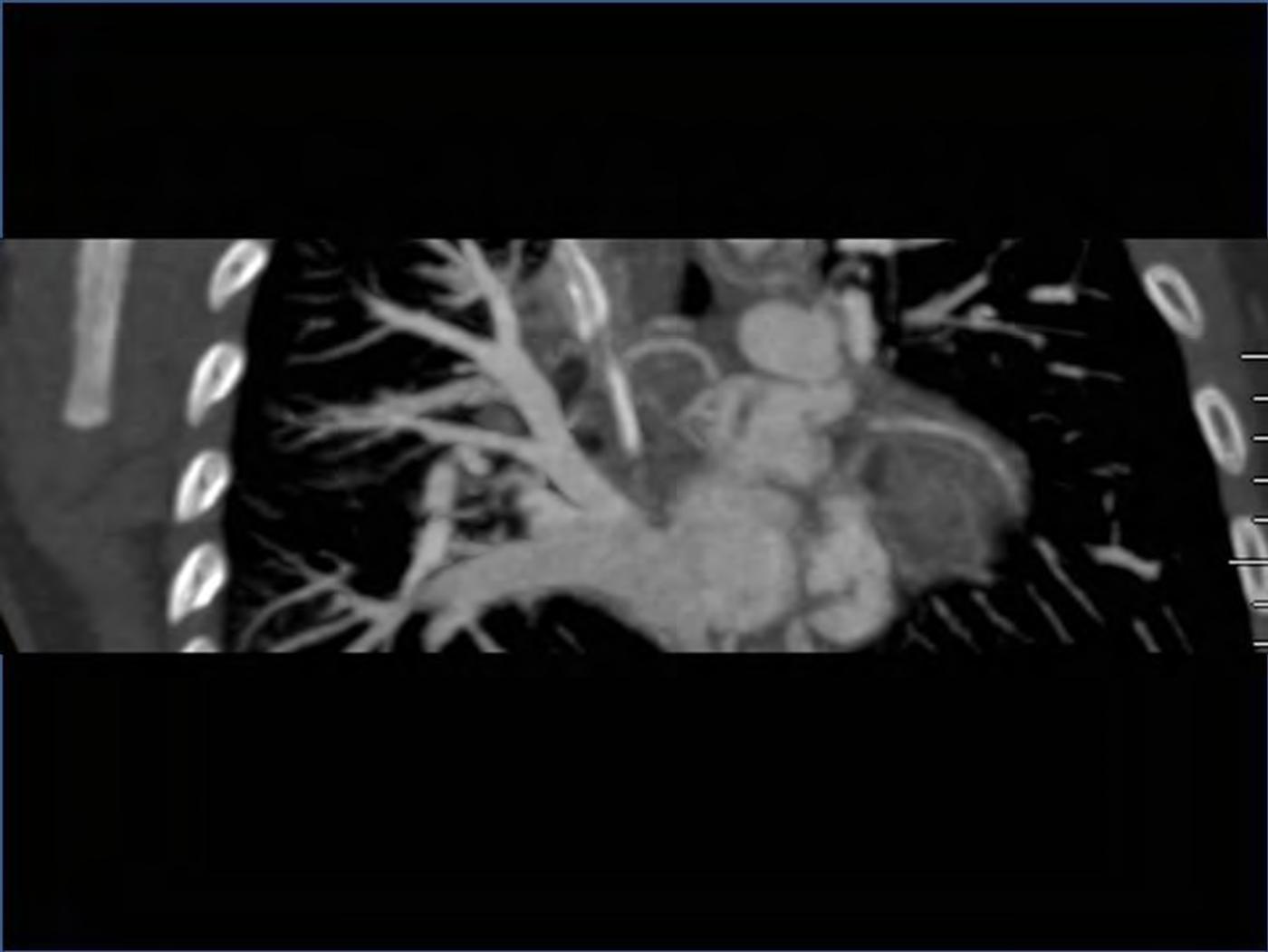 2025 Pediatric Heart Forum Presentation 344페이지
