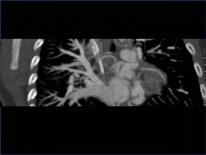 2025 Pediatric Heart Forum Presentation 344페이지