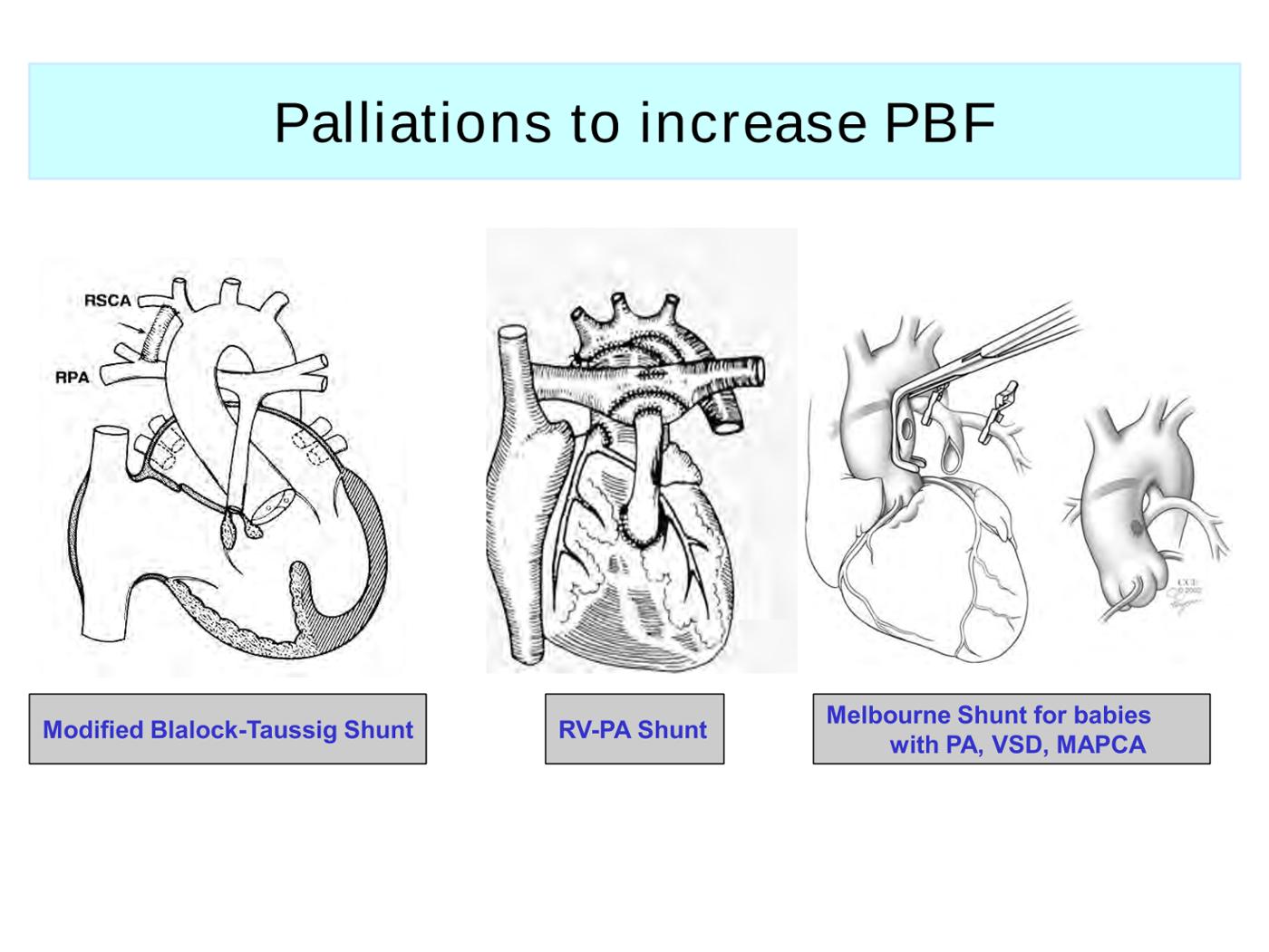 2025 Pediatric Heart Forum Presentation 272페이지