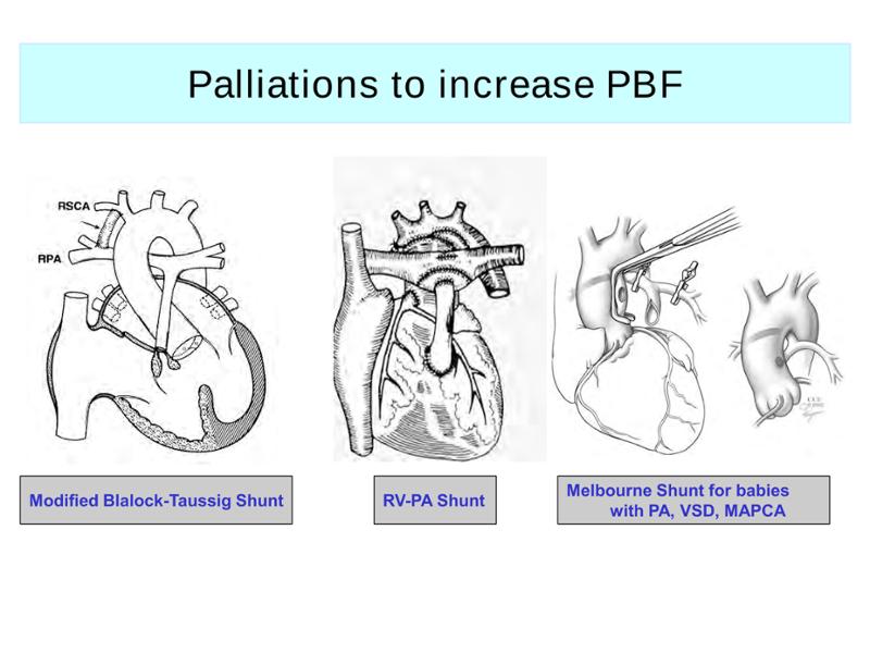 2025 Pediatric Heart Forum Presentation 272페이지