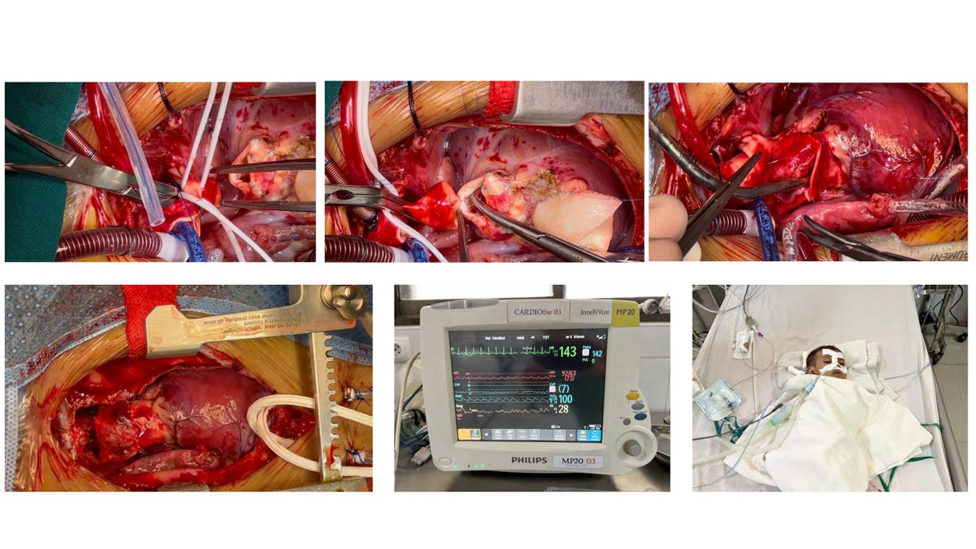 2025 Pediatric Heart Forum Presentation 394페이지