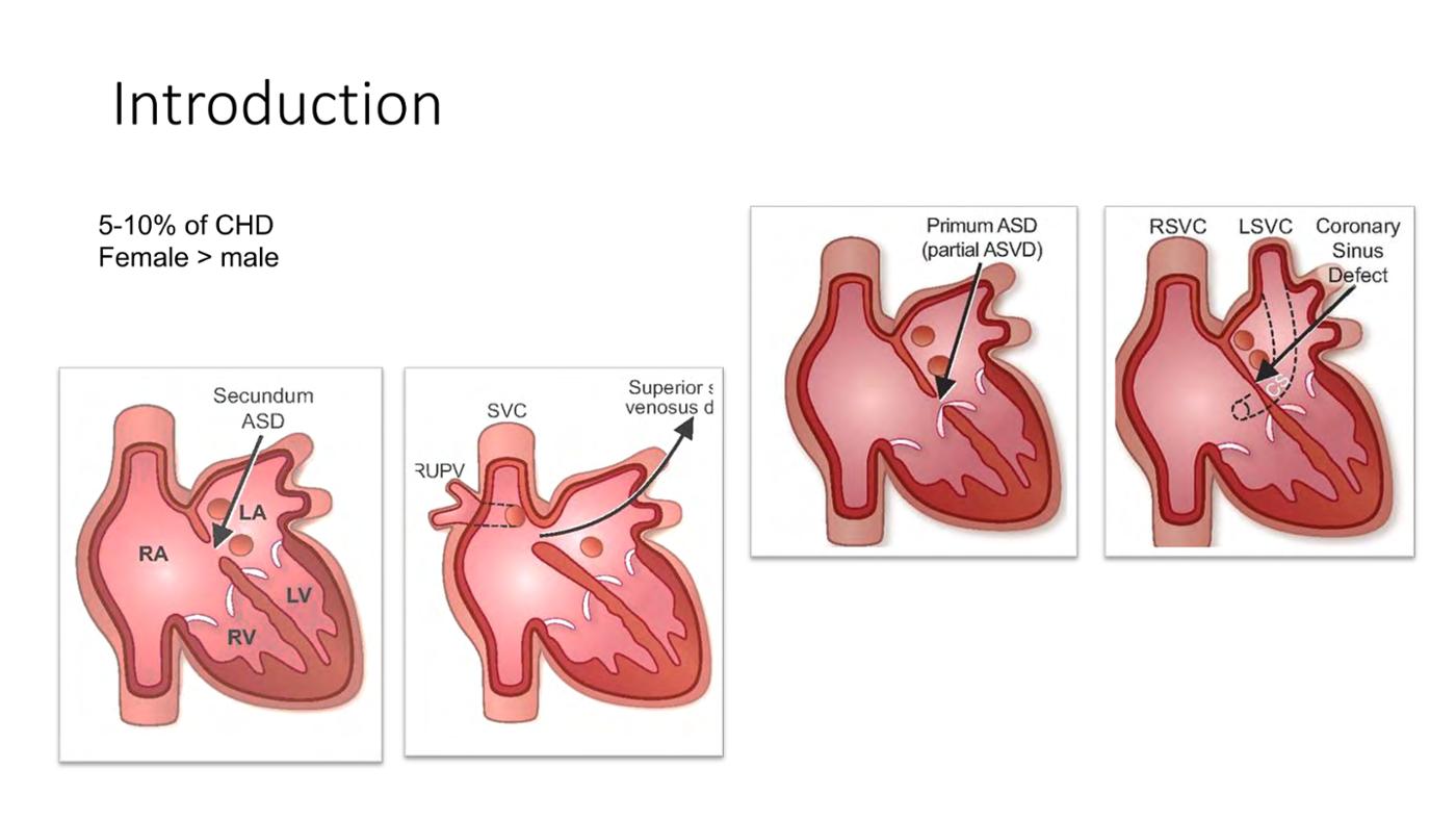 2025 Pediatric Heart Forum Presentation 133페이지
