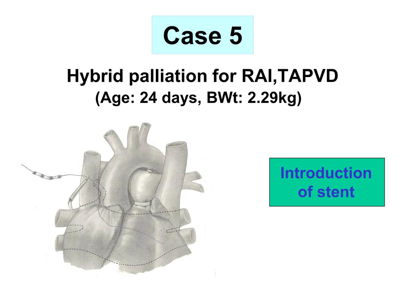 2025 Pediatric Heart Forum Presentation 353페이지