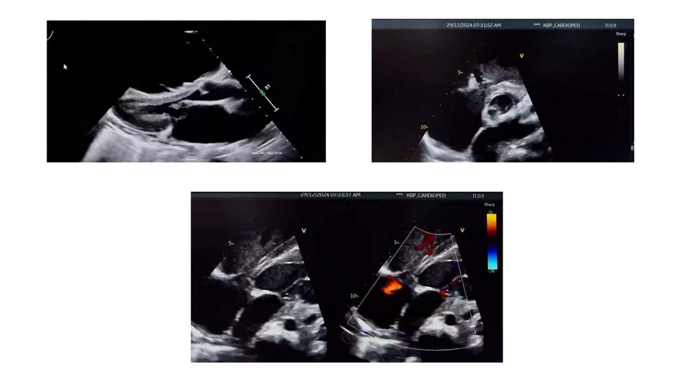 2025 Pediatric Heart Forum Presentation 153페이지
