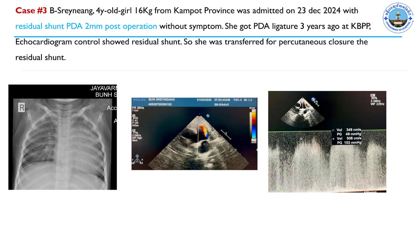 2025 Pediatric Heart Forum Presentation 66페이지