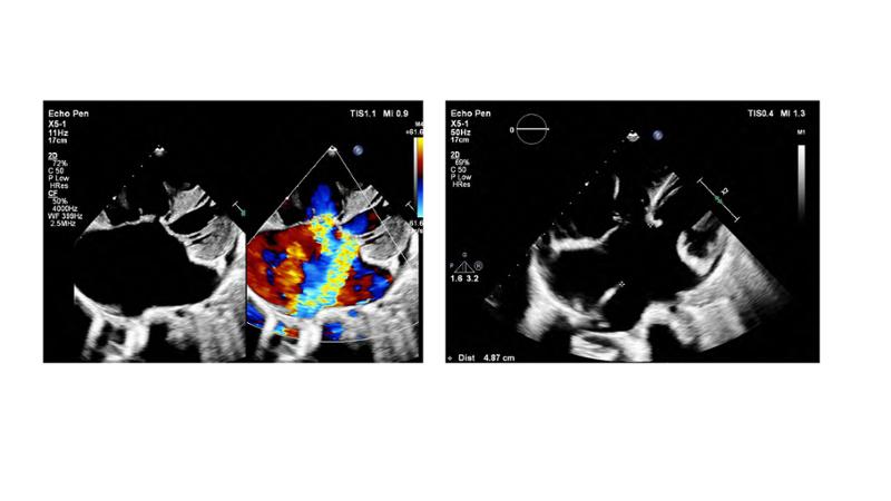 2025 Pediatric Heart Forum Presentation 155페이지