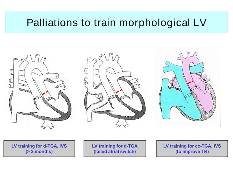 2025 Pediatric Heart Forum Presentation 289페이지
