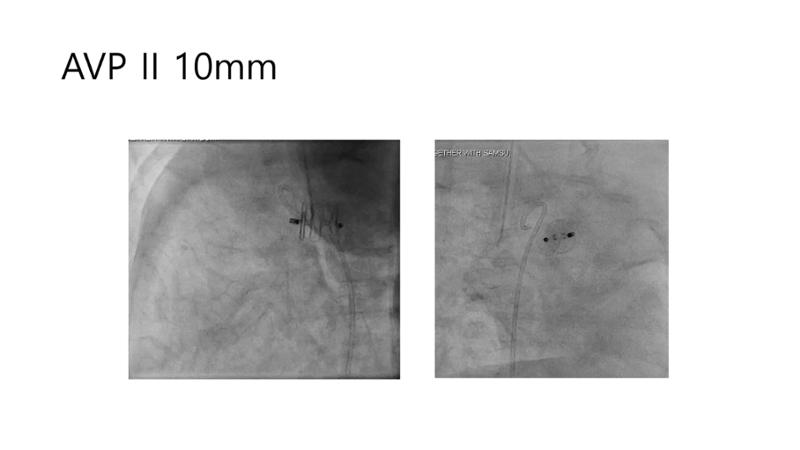 2025 Pediatric Heart Forum Presentation 26페이지