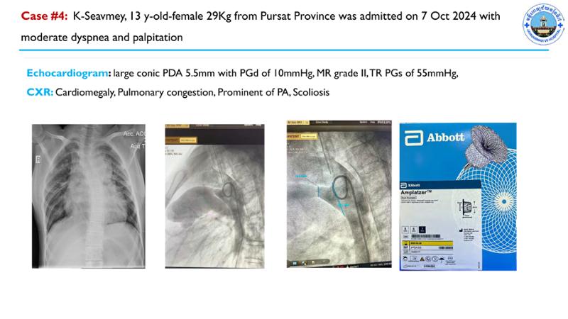 2025 Pediatric Heart Forum Presentation 68페이지