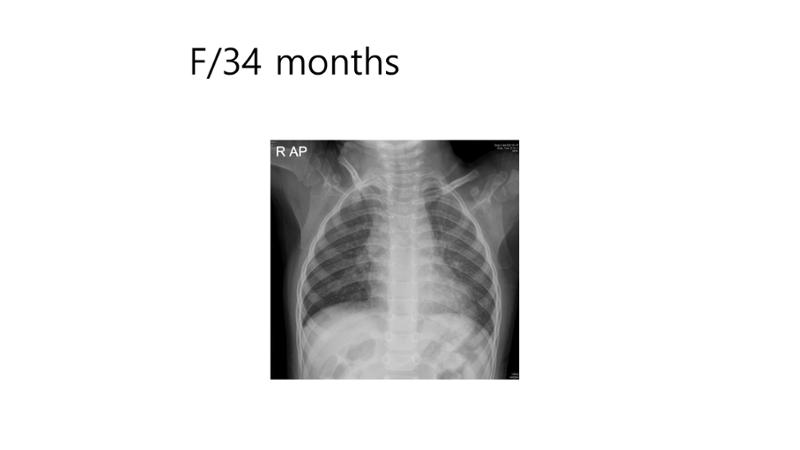 2025 Pediatric Heart Forum Presentation 28페이지