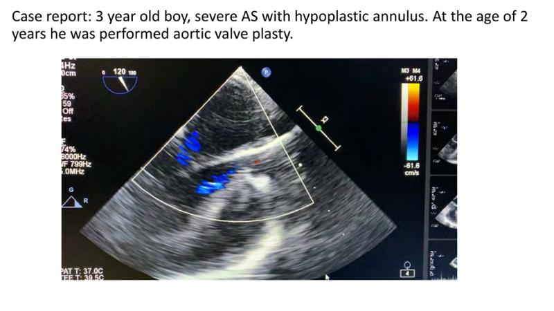 2025 Pediatric Heart Forum Presentation 384페이지