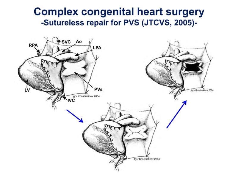 2025 Pediatric Heart Forum Presentation 253페이지