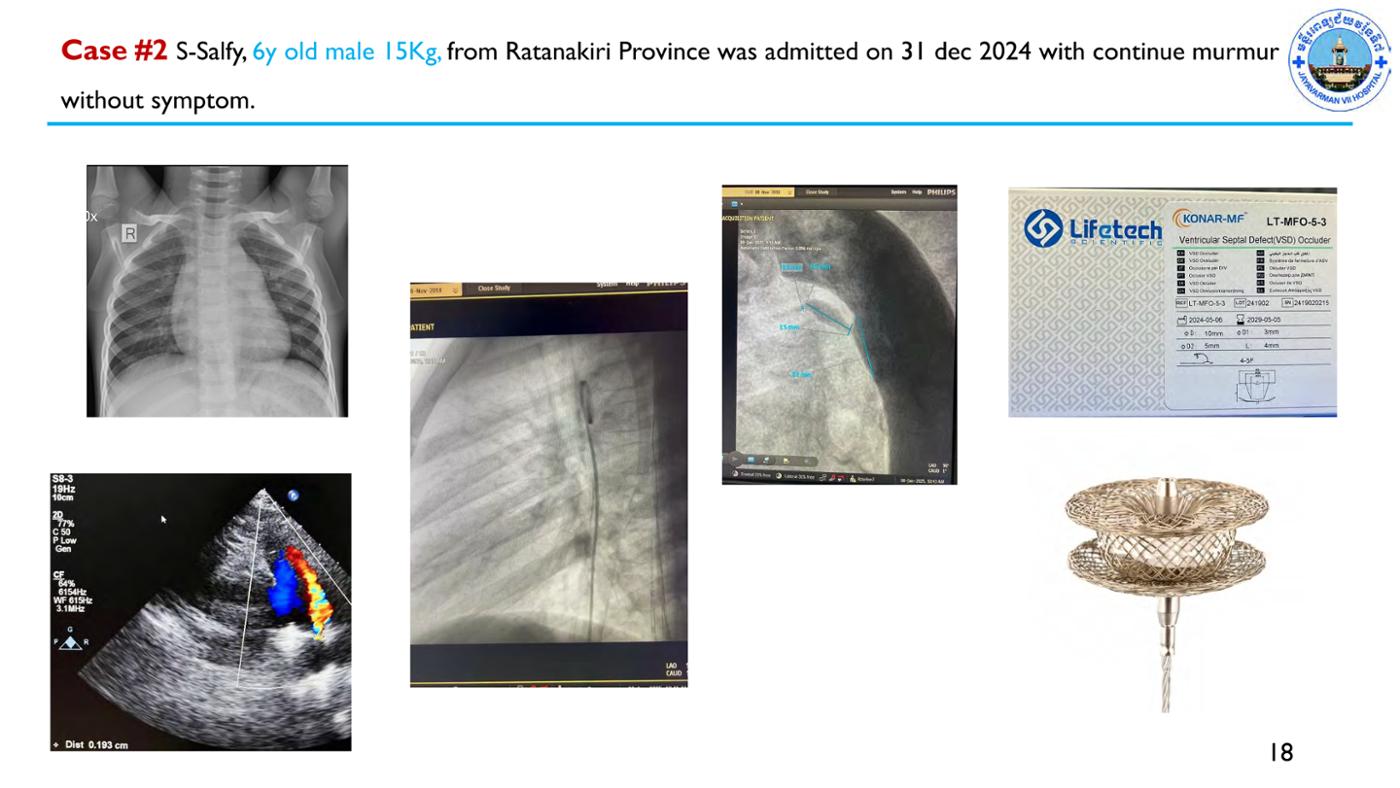 2025 Pediatric Heart Forum Presentation 64페이지