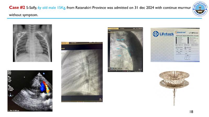 2025 Pediatric Heart Forum Presentation 64페이지