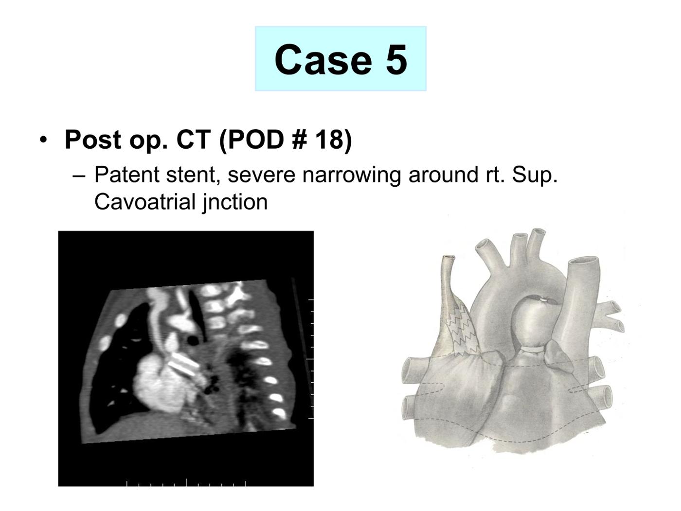 2025 Pediatric Heart Forum Presentation 357페이지