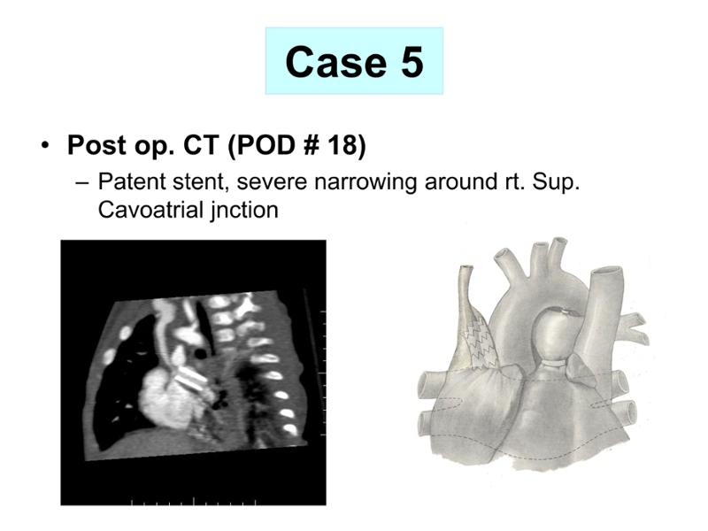 2025 Pediatric Heart Forum Presentation 357페이지