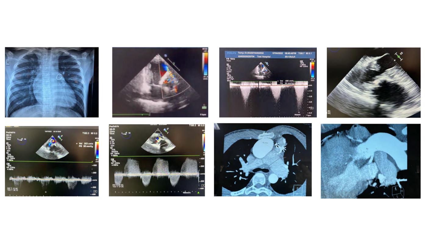 2025 Pediatric Heart Forum Presentation 399페이지