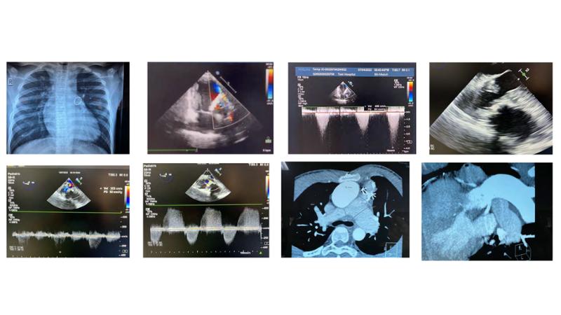 2025 Pediatric Heart Forum Presentation 399페이지